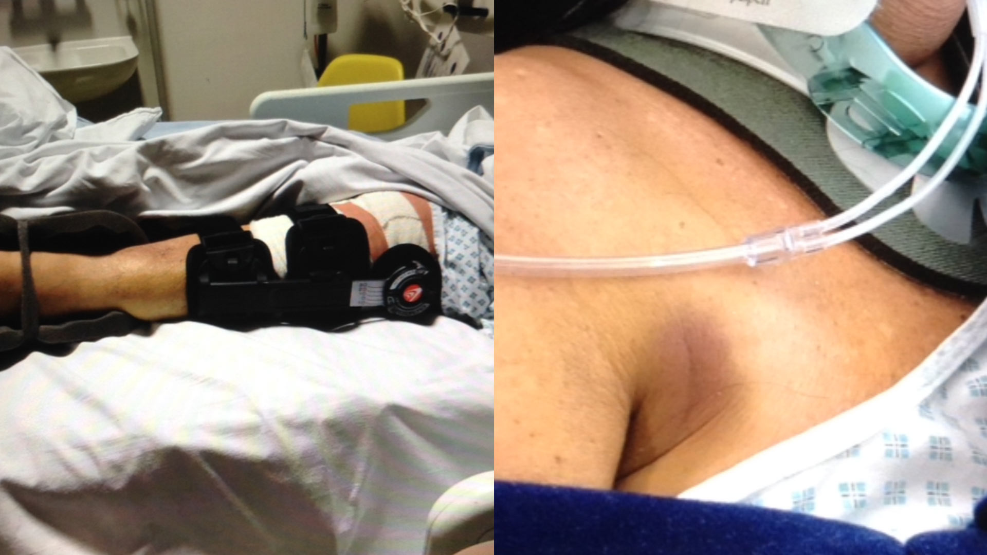 Sharon-hospital-injury-leg-brace.jpg